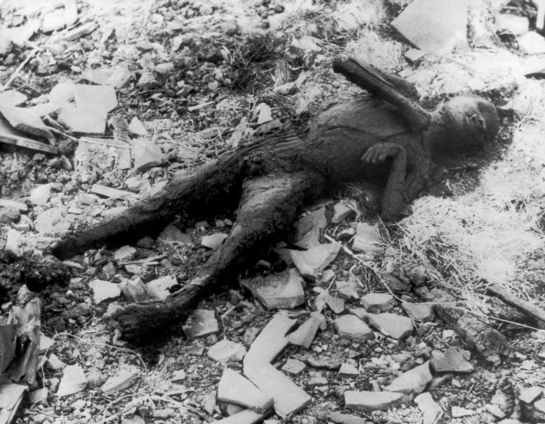 Nagasaki_-_person_burned